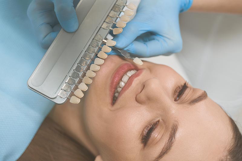 Zahnaufhellung Berlin